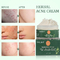 La cicatriz de limpiamiento herbaria orgánica natural del acné del cuidado de piel de la crema de cara quita el tratamiento